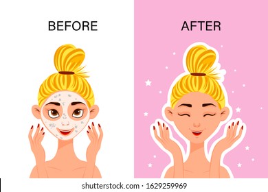 Female character "before" and "after" cosmetic mask. Cartoon style. Vector illustration