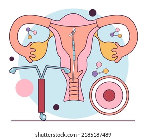 1,205 Iud Images, Stock Photos & Vectors | Shutterstock