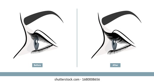 Female Eye Before And After Eyelash Extension. Comparison Of Natural And Volume Eyelashes. Side View. Infographic Vector Illustration 