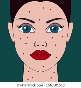 Female face with allergic rash. Vector illustration