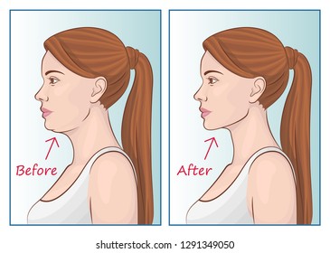 Female face before and after sports.