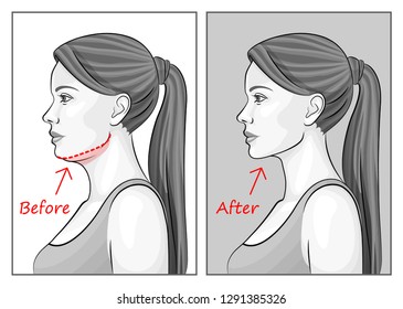 Female face before and after sports. Red outline showing overweight.