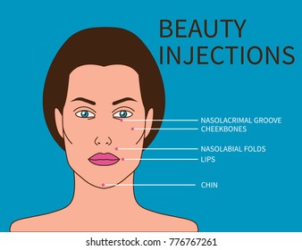 Female face with scheme of beauty injections. Vector illustration for beauty salon, beautician. Hyaluronic acid injections, wrinkle correction and sculpturing of face.