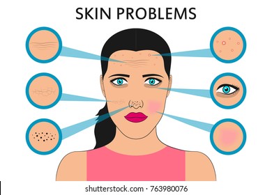 Female face skin problems. Acne and pimples, black spots, redness, dryness, circles under the eyes and wrinkles. Vector illustration for cosmetic brochure or banner, poster.