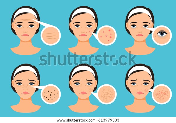 肌の問題のある女性の顔のベクターイラスト 問題領域を持つ女性 のベクター画像素材 ロイヤリティフリー