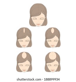 Types Hair Loss Images Stock Photos Vectors Shutterstock