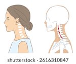 Female head and skeleton with normal cervical spine