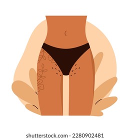 Female hips with flower tattoo and hairy bikini. Pubic hair. Body Positive,  love yourself, normalize female body hair. Vector illustration in cartoon style. Isolated white background.
