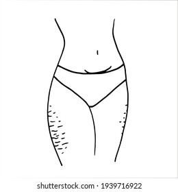 female hips with stretch marks - vector sketch. Black linear vector illustration of the lower body of a woman in underpants