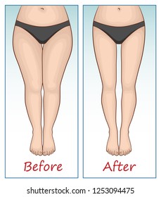 Female legs and hips before and after sports.