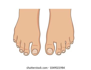 Female or male foot sole, barefoot, top view. Toenails with pedicure.Vector illustration, hand drawn cartoon style isolated on white.