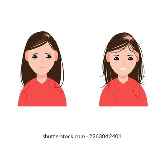 Weibliche Muster Baldness, Alopezie, Art des Haarausfalls bei Frauen, Vektorgrafik einzeln auf weißem Hintergrund. Schritt der Haare zu verlieren Alopezie. Illustration zum Haarproblem-Konzept.
