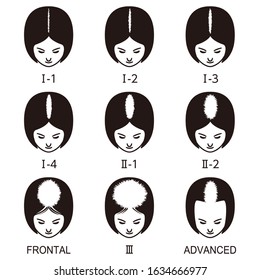 Female Pattern Hair Loss Set. Stages Of Baldness In Women.