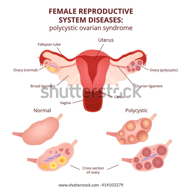 Plumper was uterus bedeutet Pathology Outlines