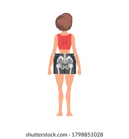 Female Thigh Bone Back View Roentgen Vector Illustration. Radiographic Procedure Concept