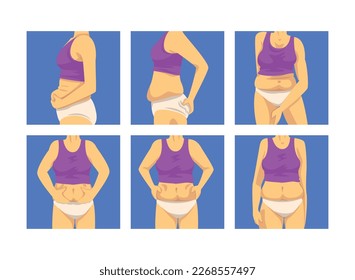 Torso femenino con el conjunto de vectores de barriga y músculos suaves