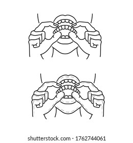 Female undergoing clear aligner treatment vector outline illustration on white background.