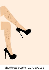 Female unshaved hairy legs, Feminine poster, body positivity image, women solidarity and freedom