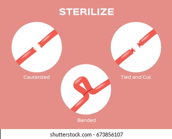 female uterus sterilize vector