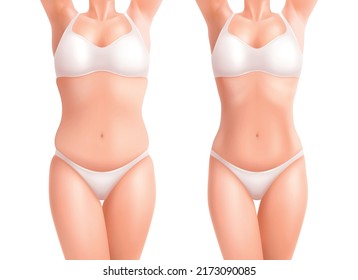 Female Woman Weight Body Set With Before And After Realistic Views Of Skinny And Fat Bodies Vector Illustration