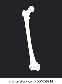 Femur Bone