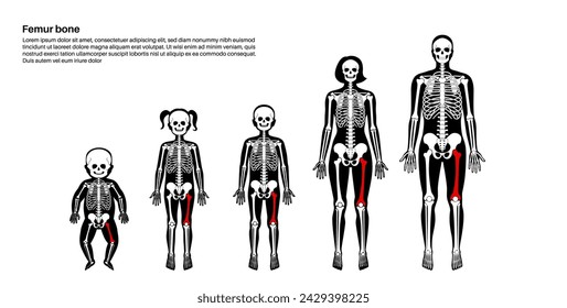 Femur bone anatomical poster. Thigh in human skeletal system diagram. Skeleton in male, female, baby, child and adult silhouettes. Bones, cartilage and joints in body xray medical vector illustration