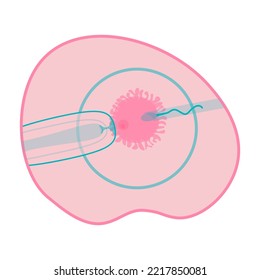 Fertilization in vitro.  IVF ICSI procedure in lab. In vitro fertilization in the laboratory, test tube. Vector illustration