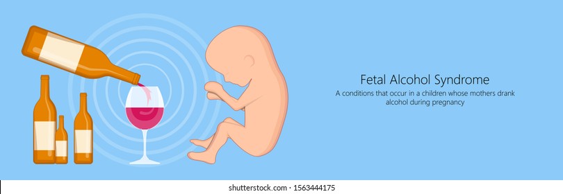 Fetal alcohol spectrum syndrome disorders conditions mother drank during pregnancy cause brain damage and birth defect in children facial