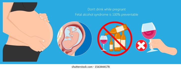 Fetal alcohol spectrum syndrome disorders conditions mother drank during pregnancy cause brain damage and birth defect in children facial