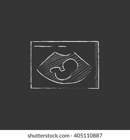 Fetal ultrasound. Drawn in chalk icon.