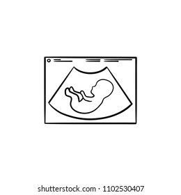 Fetal ultrasound hand drawn outline doodle icon. Pregnancy sonogram of a fetus in womb vector sketch illustration for print, web, mobile and infographics isolated on white background.