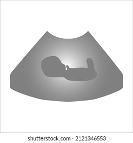 Fetal ultrasound icon for web, mobile and infographics. Hand drawn vector dark gray icon isolated on light gray background.Pregnancy screening. Vector