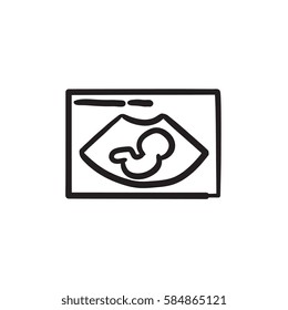 Fetal ultrasound vector sketch icon isolated on background. Hand drawn Fetal ultrasound icon. Fetal ultrasound sketch icon for infographic, website or app.