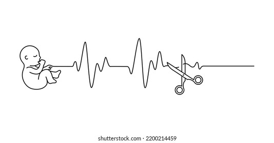 Fetus baby mit Herzschlag Puls von Scheren Umriss Vektorgrafik. Concept Fehlleitung oder Abtreibung