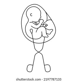 Fetus baby is removed from the womb with gynecological forceps line style vector illustration