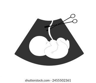 fetus baby with umbilical cord cut off with surgical forceps after miscarriage or abortion loss pregnancy vector illustration