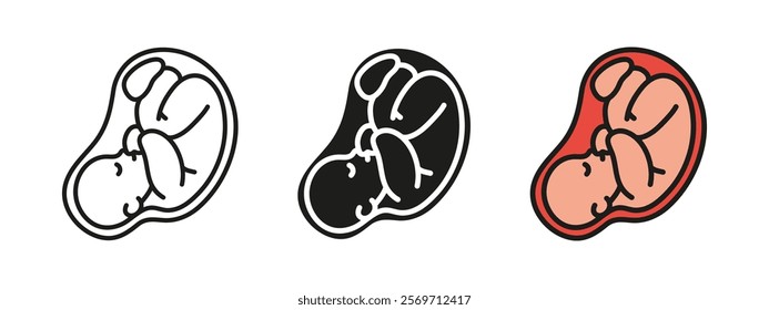 Fetus icon. Human embryo vector illustration. Pregnancy and motherhood symbol. Unborn baby child infant sign. Ultrasound pictogram. Uterus or womb germ silhouette. Childbirth and reproduction concept.