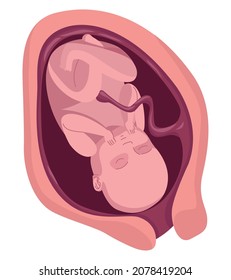 fetus with nine months of gestation