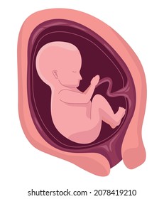 Fötus mit sechsmonatiger Gestation