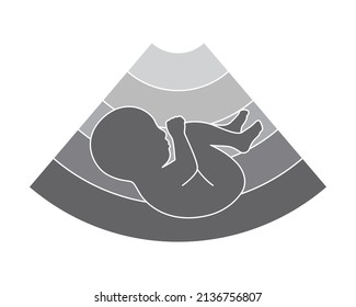 Fetus ultrasound graphic icon. Symbol ultrasound examination pregnancy. Sign isolated on white background. Vector illustration