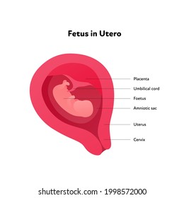 Fetus in utero gynecology infographic diagram. Vector flat healthcare illustration. Embryo in womb with text isolated on white background. Design for health care, education, science