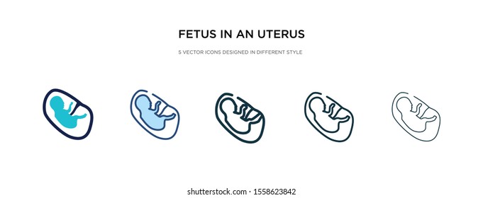 fetus in an uterus icon in different style vector illustration. two colored and black fetus in an uterus vector icons designed filled, outline, line and stroke style can be used for web, mobile, ui