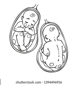 Fetus vector icon, prenatal human child with placenta silhouette isolated on white background. Picture of baby and placenta inside the womb.Simple element illustration. Pregnancy symbol design. 