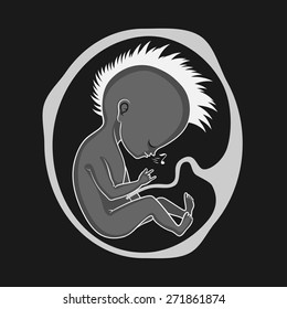 Fetus Whistler in the Womb