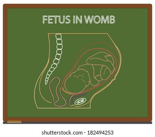 fetus in womb on chalk board