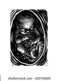 Fetus Woodcut