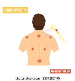 Fibromyalgia disease. Illustration of a man with pain in a body. Red light therapy, innovative treatment