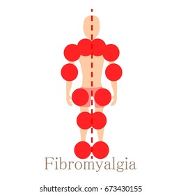 Fibromyalgia Icon. Cartoon Illustration Of Fibromyalgia Vector Icon For Web Isolated On White Background