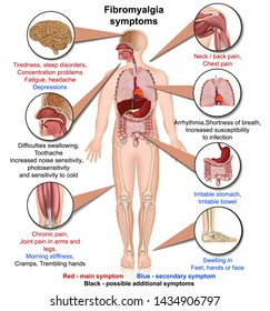 fibromyalgia symptoms medical vector illustration isolated on white background infographic