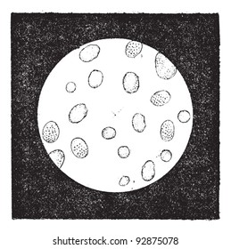 Fig. 2. Glóbulos blancos o leucocitos, ilustración vintage grabada. Diccionario de palabras y cosas - Larive y Fleury - 1895.